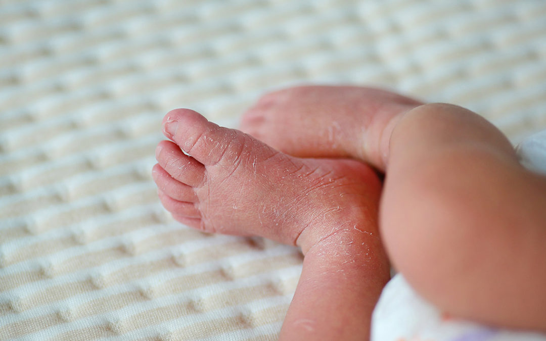 What Is the Birth Injury Lawsuit Statute of Limitations in Texas?